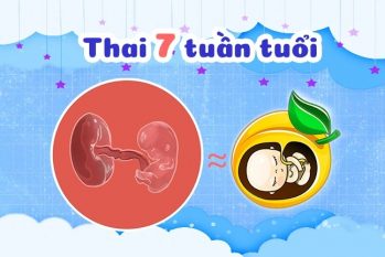 Phá thai 7 tuần: Phương pháp an toàn và lưu ý cần biết