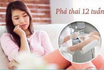 Phá thai 12 tuần không đau: Quy trình an toàn, hạn chế biến chứng