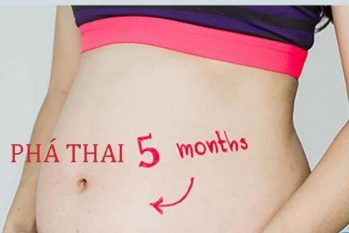 Bỏ thai 5 tháng – Những điều quan trọng cần ghi nhớ!