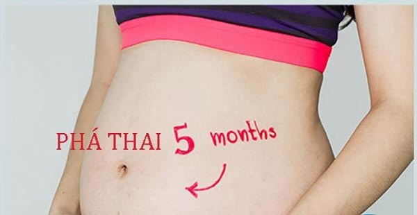 6+ Thông tin về phá thai 5 tháng chị em nên tham khảo